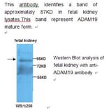 ADAM19 Antibody from Signalway Antibody (39209) - Antibodies.com