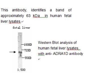 ADRA1D Antibody from Signalway Antibody (39215) - Antibodies.com