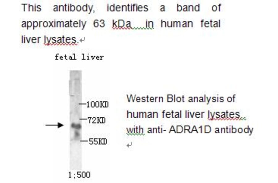 ADRA1D Antibody from Signalway Antibody (39215) - Antibodies.com