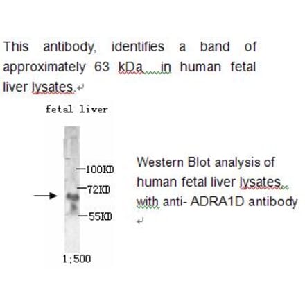 ADRA1D Antibody from Signalway Antibody (39215) - Antibodies.com