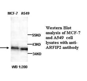 ARFIP2 Antibody from Signalway Antibody (39257) - Antibodies.com