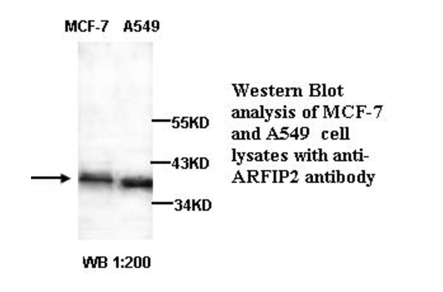 ARFIP2 Antibody from Signalway Antibody (39257) - Antibodies.com
