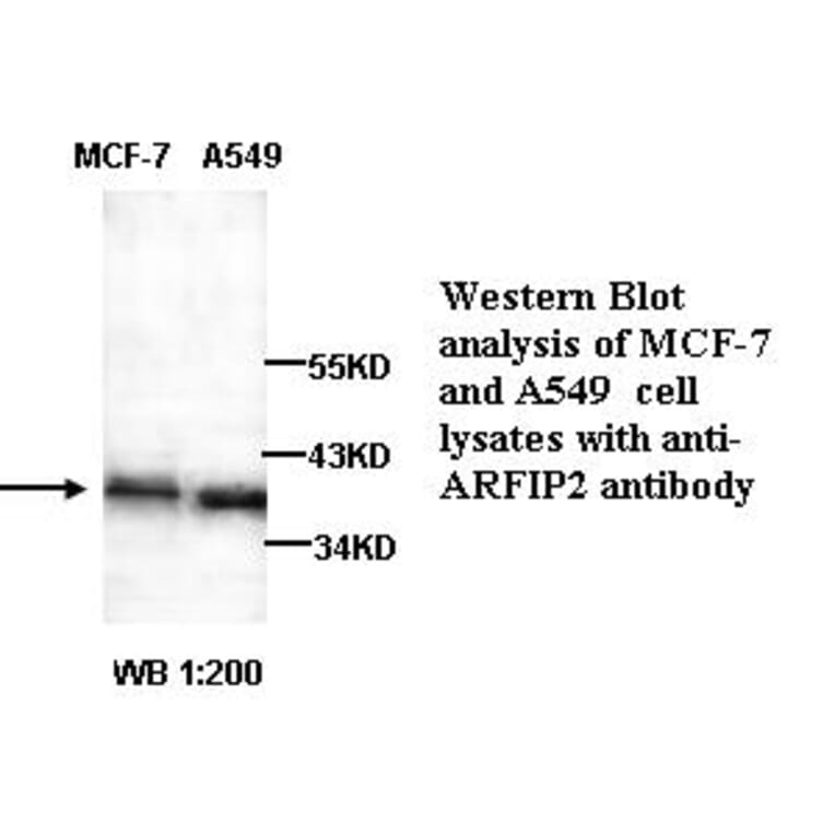 ARFIP2 Antibody from Signalway Antibody (39257) - Antibodies.com