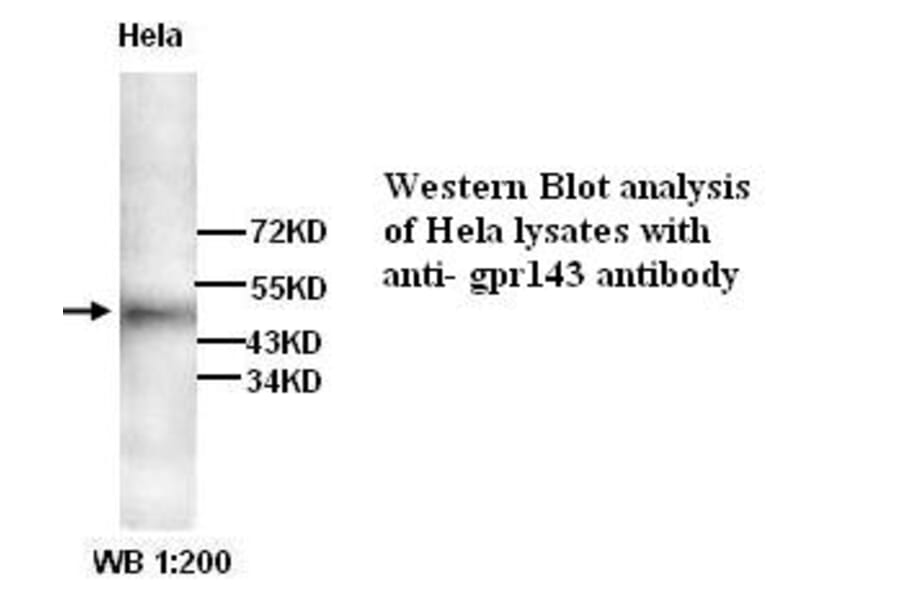 GPR143 Antibody from Signalway Antibody (39269) - Antibodies.com