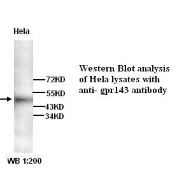 GPR143 Antibody from Signalway Antibody (39269) - Antibodies.com