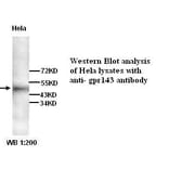 GPR143 Antibody from Signalway Antibody (39269) - Antibodies.com