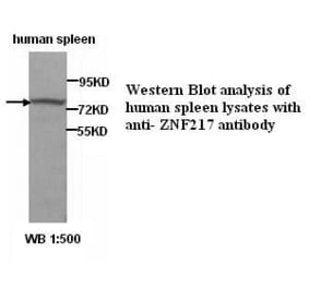 ZNF217 Antibody from Signalway Antibody (39286) - Antibodies.com