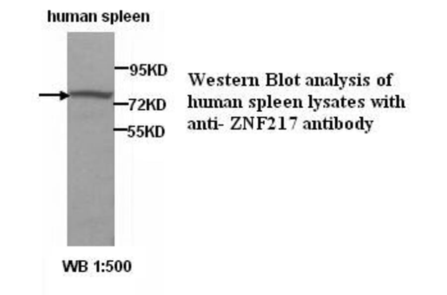 ZNF217 Antibody from Signalway Antibody (39286) - Antibodies.com