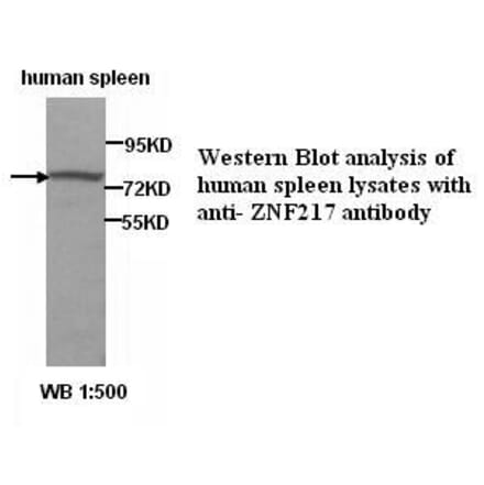 ZNF217 Antibody from Signalway Antibody (39286) - Antibodies.com