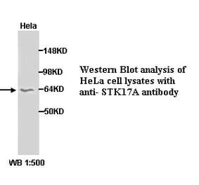 STK17A Antibody from Signalway Antibody (39288) - Antibodies.com