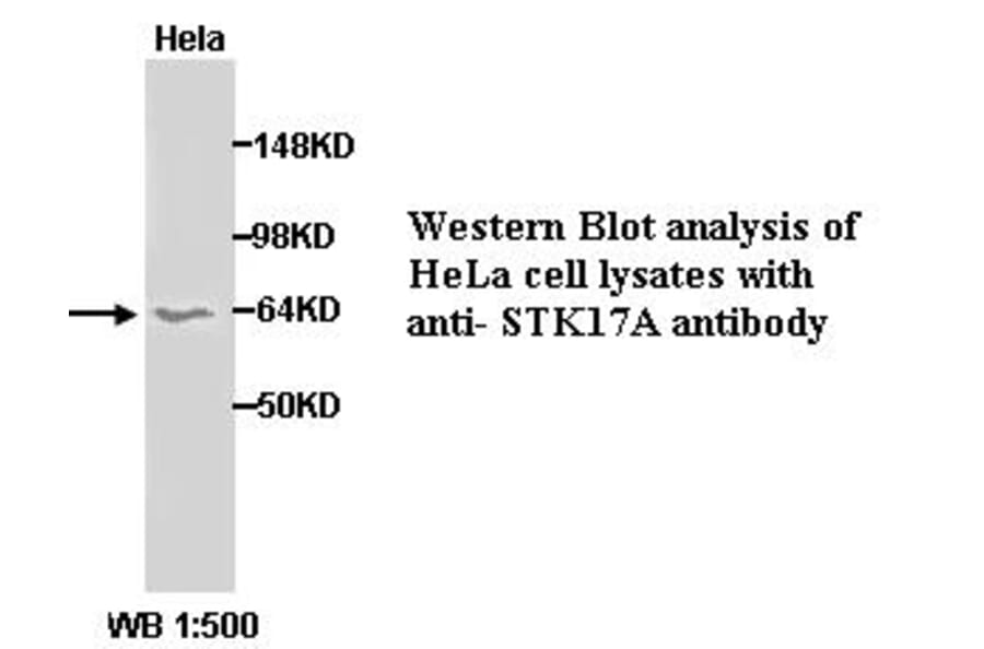 STK17A Antibody from Signalway Antibody (39288) - Antibodies.com