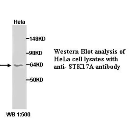 STK17A Antibody from Signalway Antibody (39288) - Antibodies.com