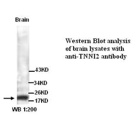TNNI2 Antibody from Signalway Antibody (39297) - Antibodies.com