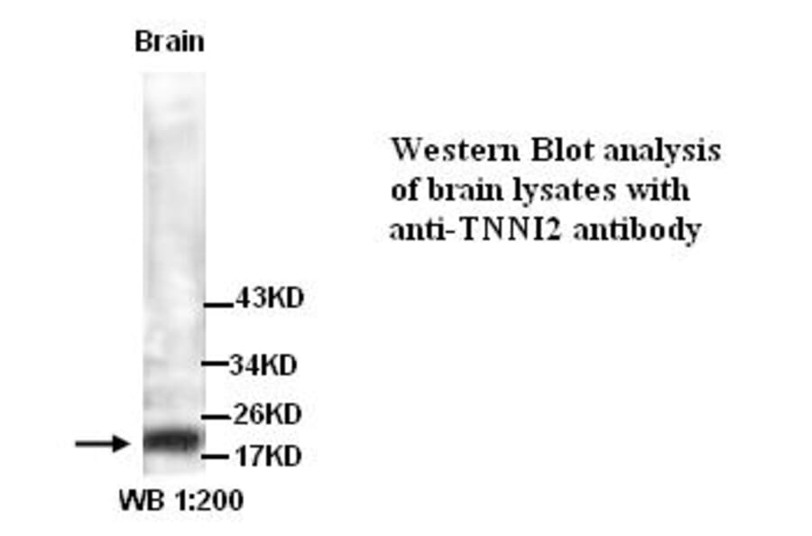 TNNI2 Antibody from Signalway Antibody (39297) - Antibodies.com
