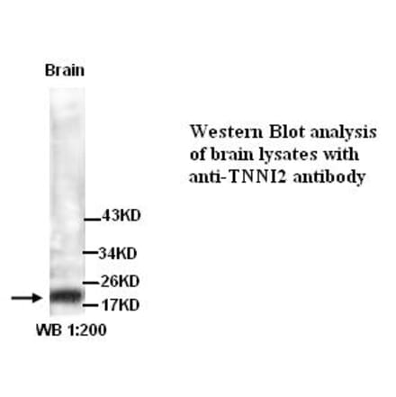 TNNI2 Antibody from Signalway Antibody (39297) - Antibodies.com