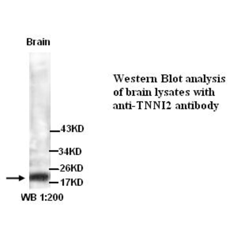 TNNI2 Antibody from Signalway Antibody (39297) - Antibodies.com