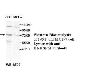 HNRNPM Antibody from Signalway Antibody (39524) - Antibodies.com