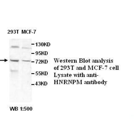 HNRNPM Antibody from Signalway Antibody (39524) - Antibodies.com