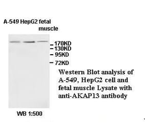 AKAP13 Antibody from Signalway Antibody (39528) - Antibodies.com