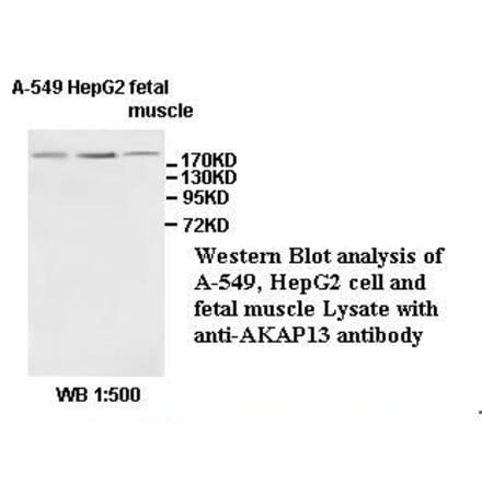 AKAP13 Antibody from Signalway Antibody (39528) - Antibodies.com