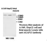 AKAP13 Antibody from Signalway Antibody (39528) - Antibodies.com