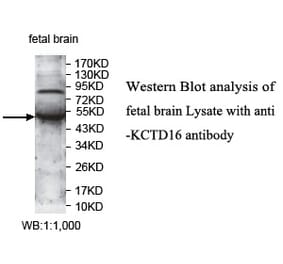 KCTD16 Antibody from Signalway Antibody (39732) - Antibodies.com