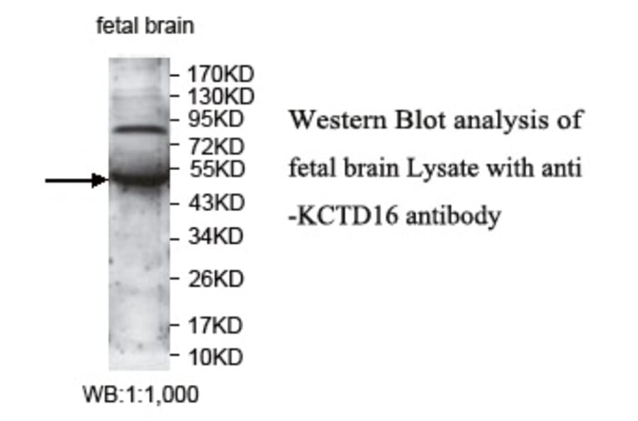 KCTD16 Antibody from Signalway Antibody (39732) - Antibodies.com