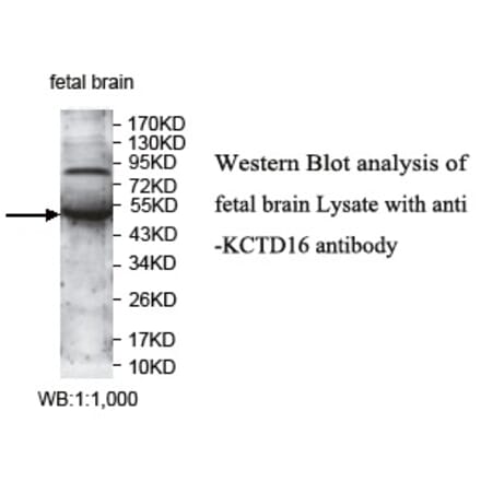 KCTD16 Antibody from Signalway Antibody (39732) - Antibodies.com