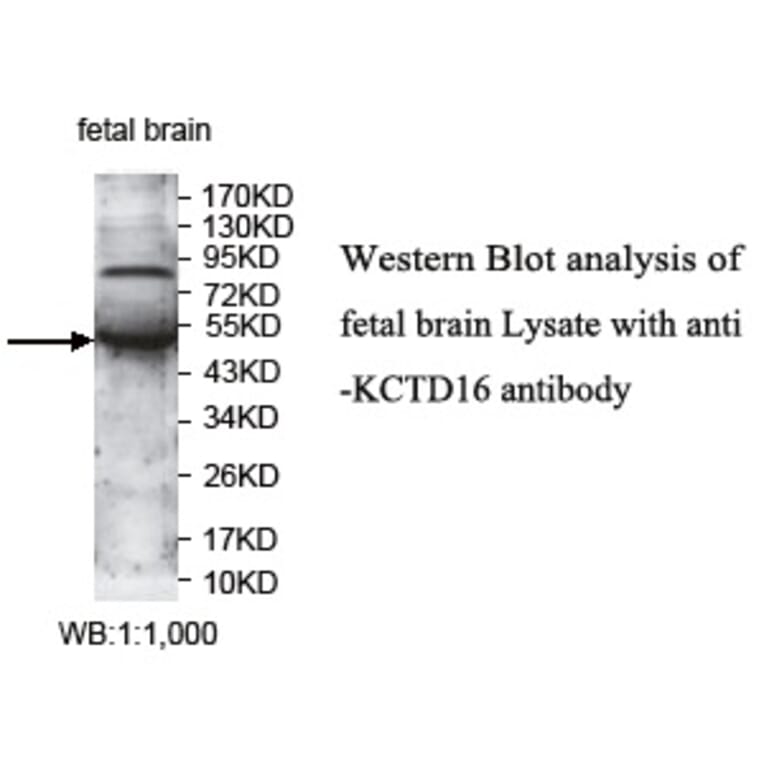 KCTD16 Antibody from Signalway Antibody (39732) - Antibodies.com
