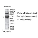 KCTD16 Antibody from Signalway Antibody (39732) - Antibodies.com