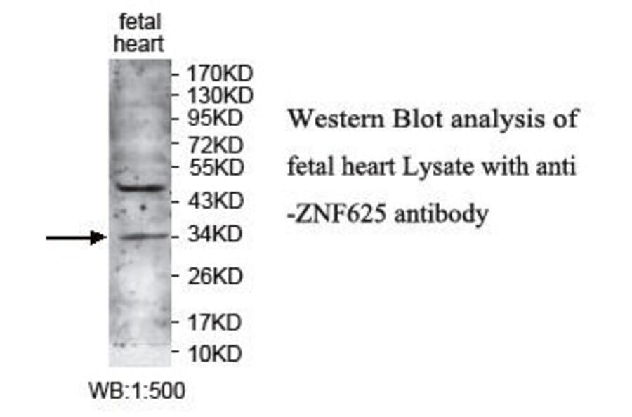 ZNF625 Antibody from Signalway Antibody (39733) - Antibodies.com