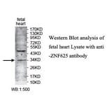 ZNF625 Antibody from Signalway Antibody (39733) - Antibodies.com