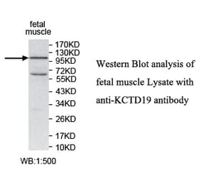 KCTD19 Antibody from Signalway Antibody (39740) - Antibodies.com