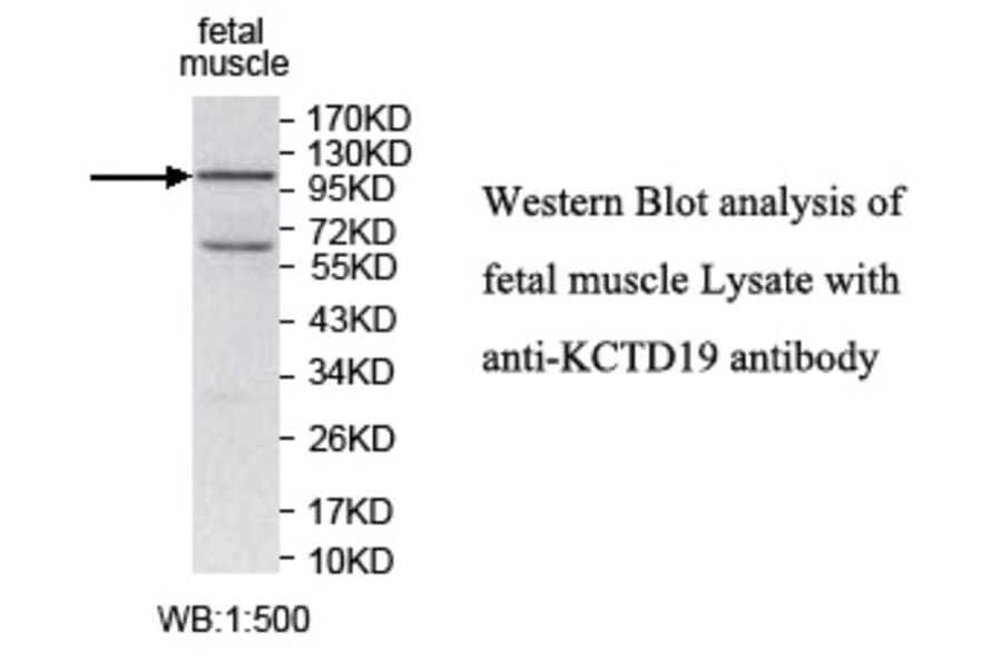 KCTD19 Antibody from Signalway Antibody (39740) - Antibodies.com