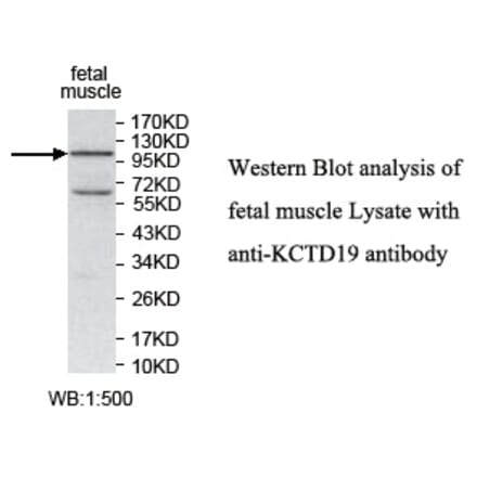 KCTD19 Antibody from Signalway Antibody (39740) - Antibodies.com