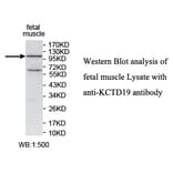 KCTD19 Antibody from Signalway Antibody (39740) - Antibodies.com