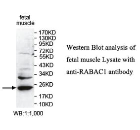 RABAC1 Antibody from Signalway Antibody (39743) - Antibodies.com