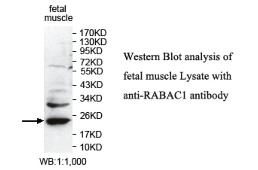 RABAC1 Antibody from Signalway Antibody (39743) - Antibodies.com