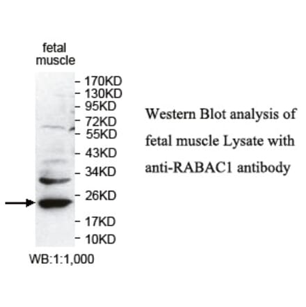 RABAC1 Antibody from Signalway Antibody (39743) - Antibodies.com