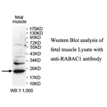 RABAC1 Antibody from Signalway Antibody (39743) - Antibodies.com