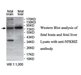 NFKBIZ Antibody from Signalway Antibody (39753) - Antibodies.com