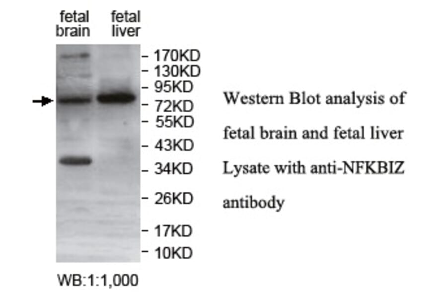 NFKBIZ Antibody from Signalway Antibody (39753) - Antibodies.com