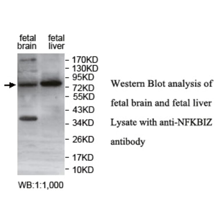 NFKBIZ Antibody from Signalway Antibody (39753) - Antibodies.com