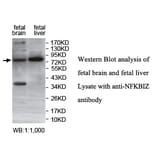 NFKBIZ Antibody from Signalway Antibody (39753) - Antibodies.com