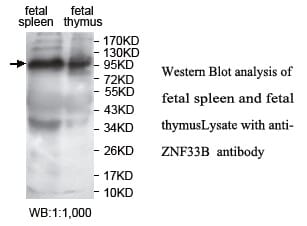 Anti-ZNF33B Antibody