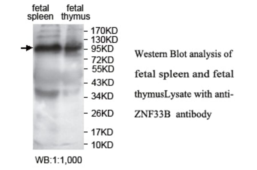 ZNF33B Antibody from Signalway Antibody (39756) - Antibodies.com
