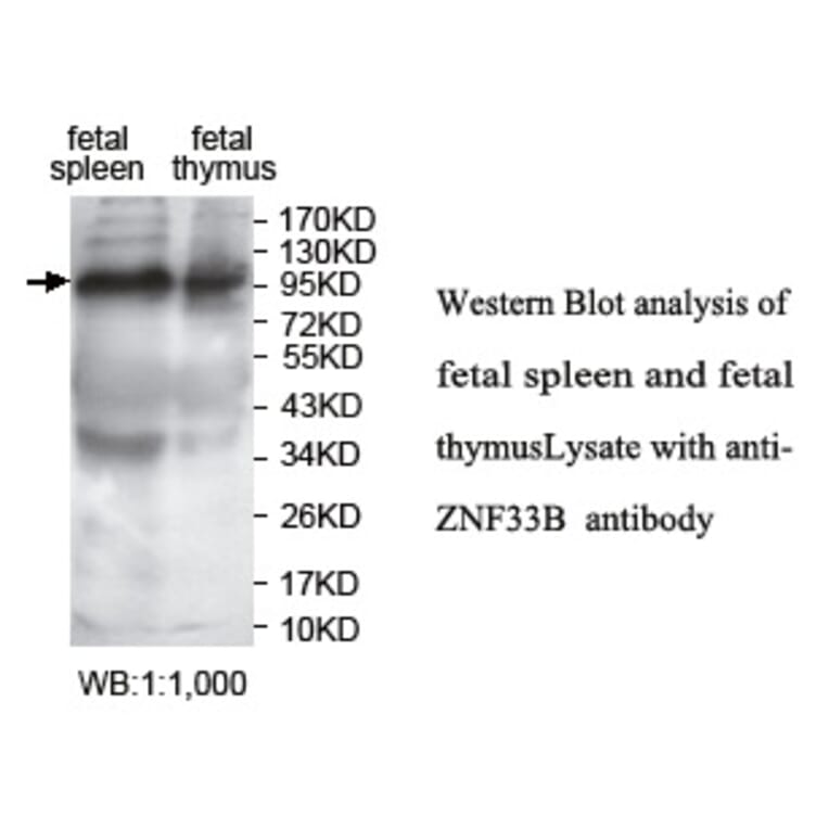 ZNF33B Antibody from Signalway Antibody (39756) - Antibodies.com