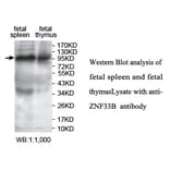 ZNF33B Antibody from Signalway Antibody (39756) - Antibodies.com