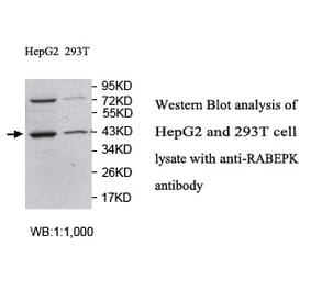 RABEPK Antibody from Signalway Antibody (39757) - Antibodies.com