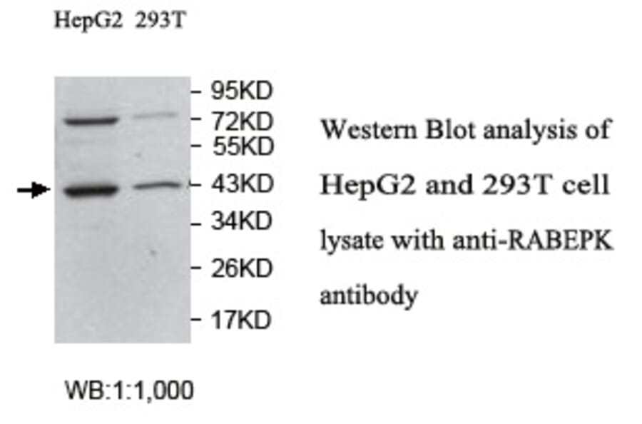 RABEPK Antibody from Signalway Antibody (39757) - Antibodies.com